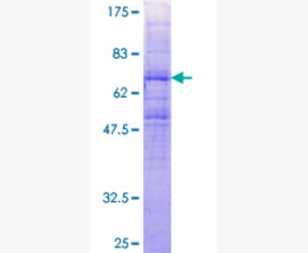 Recombinant Mouse Interleukin-11/IL-11