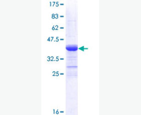 Recombinant Mouse C-C Motif Chemokine 24/CCL24/Eotaxin-2