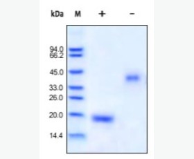 Recombinant Human C-X-C Motif Chemokine 4/CXCL4/PF4