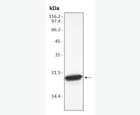 Recombinant Human V-Set and Ig Domain-Containing Protein 8/VSIG8