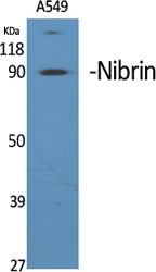 Nibrin Polyclonal Antibody