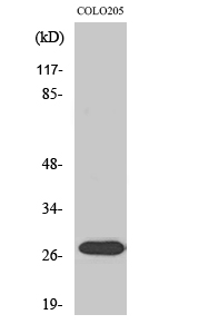 NRIP3 Polyclonal Antibody