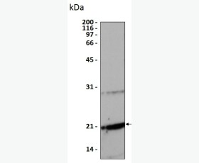 Recombinant Human Fibroblast Growth Factor 23/FGF-23