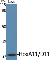 HoxA11/D11 Polyclonal Antibody