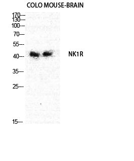 NK-1R Polyclonal Antibody