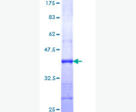 Recombinant Human C-C Motif Chemokine 1/CCL1