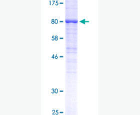 Recombinant Human C-C Motif Chemokine 16/CCL16