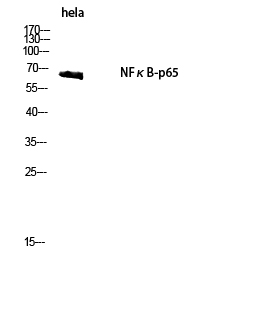 NFκB-p65 Polyclonal Antibody