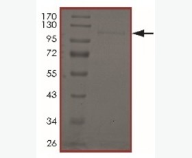 Recombinant Mouse PD-L2/B7-DC/CD273