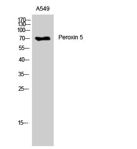 Peroxin 5 Polyclonal Antibody