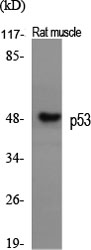 p53 Polyclonal Antibody