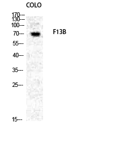 Factor XIII B Polyclonal Antibody