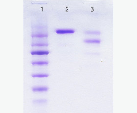 Recombinant Human Hepatocyte Growth Factor Receptor/HGF R/cMet