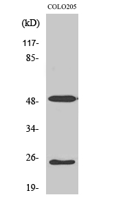 LRAT Polyclonal Antibody