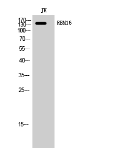 RBM16 Polyclonal Antibody