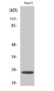 MaxiKβ Polyclonal Antibody