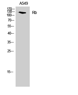 Rb Polyclonal Antibody