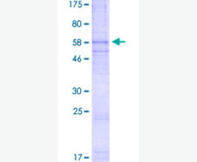 Recombinant Human Lactotransferrin/LTF