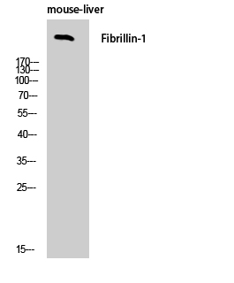 FBN1 Polyclonal Antibody