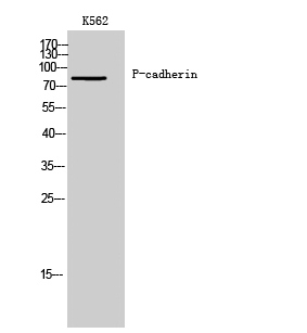 P-cadherin Polyclonal Antibody