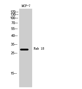 Rab 18 Polyclonal Antibody