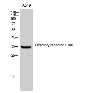 Olfactory receptor 10A6 Polyclonal Antibody