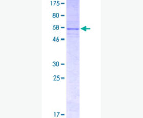 Recombinant Human Sulfotransferase/SULT1C4/SULT1C2