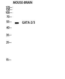 GATA-2/3 Polyclonal Antibody