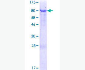 Recombinant Human GDNF Family Receptor α-1/GFRA1