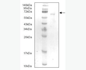 Recombinant E. coli Methionine Aminopeptidase/MetAP/MAP