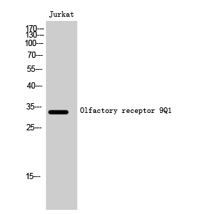 Olfactory receptor 9Q1 Polyclonal Antibody