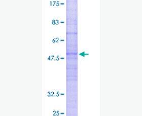 Recombinant Human Interleukin-17A/F Heterodimer/IL-17A & IL-17F