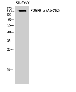 PDGFR-α Polyclonal Antibody