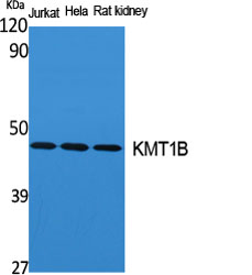 KMT1B Polyclonal Antibody