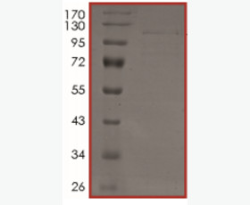 Recombinant Human Gastric Triacylglycerol Lipase/LIPF