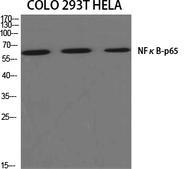 NFκB-p65 Polyclonal Antibody