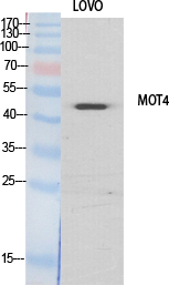 MCT4 Polyclonal Antibody