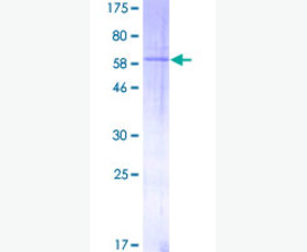 Recombinant Human Activin Receptor 2B/Activin RIIB/ACVR2B