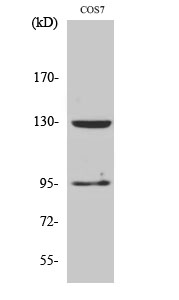 GABAB R1 Polyclonal Antibody
