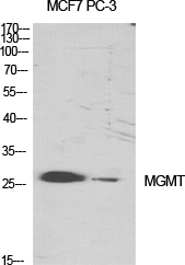 MGMT Polyclonal Antibody