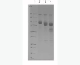 Recombinant Human Mast/stem Cell Growth Factor Receptor Kit/CD117/c-kit