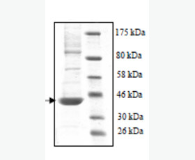 Recombinant Human Interleukin-28B/IL-28B/IFN-lambda 3