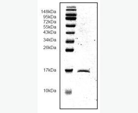 Recombinant Human Transforming Growth Factor Receptor Type II/TGFBR2