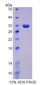 Recombinant DNA Methyltransferase 1 (DNMT1)