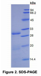 Recombinant Dipeptidyl Peptidase IV (DPP4)