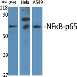 NFκB-p65 Polyclonal Antibody