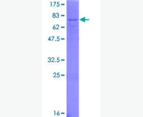 Recombinant Human C-C Motif Chemokine 28/CCL28