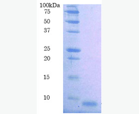 Recombinant Human Complement Factor D/Adipsin