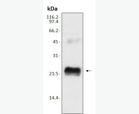 Recombinant Mouse Adiponectin/Acrp30/AdipoQ