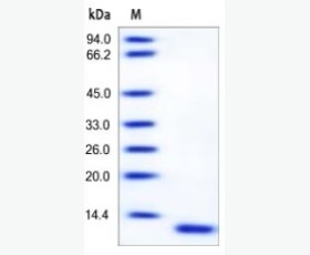 Recombinant Human Dickkopf-Related Protein 2/DKK-2